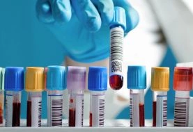 USAID funding cuts spark TB threat, exposing gaps in workforce health strategies